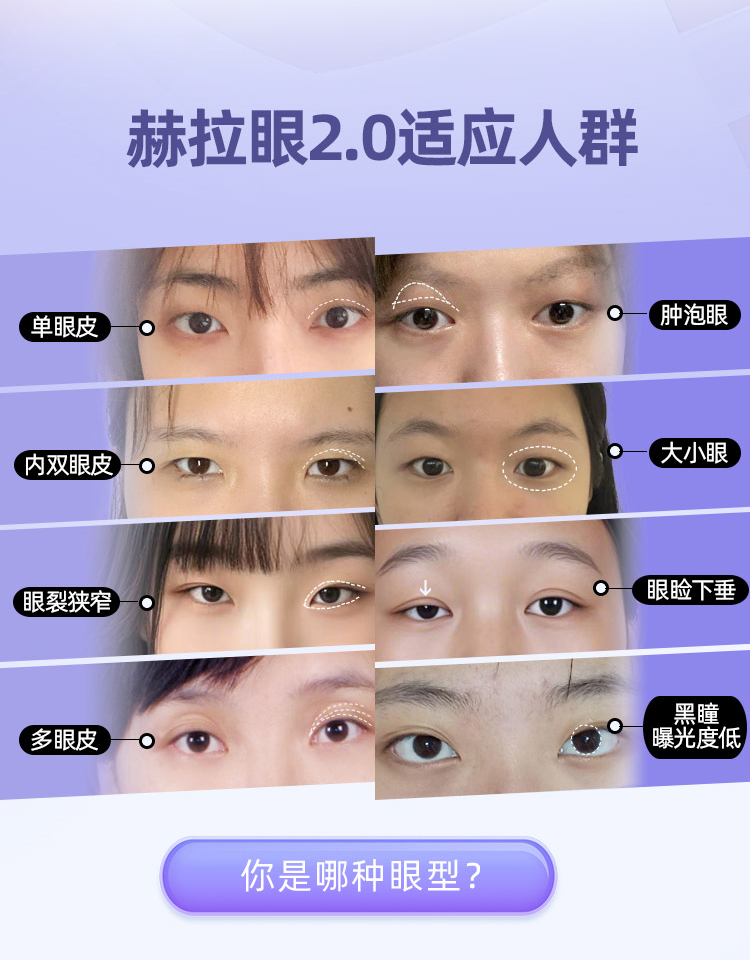 赫拉综合美眼适应人群