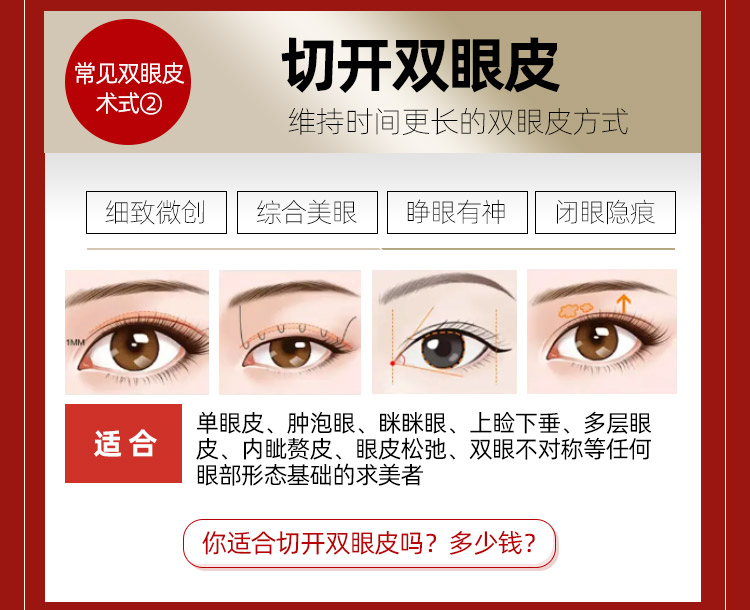 切开双眼皮适应人群