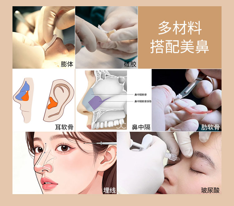华美隆鼻材料选择