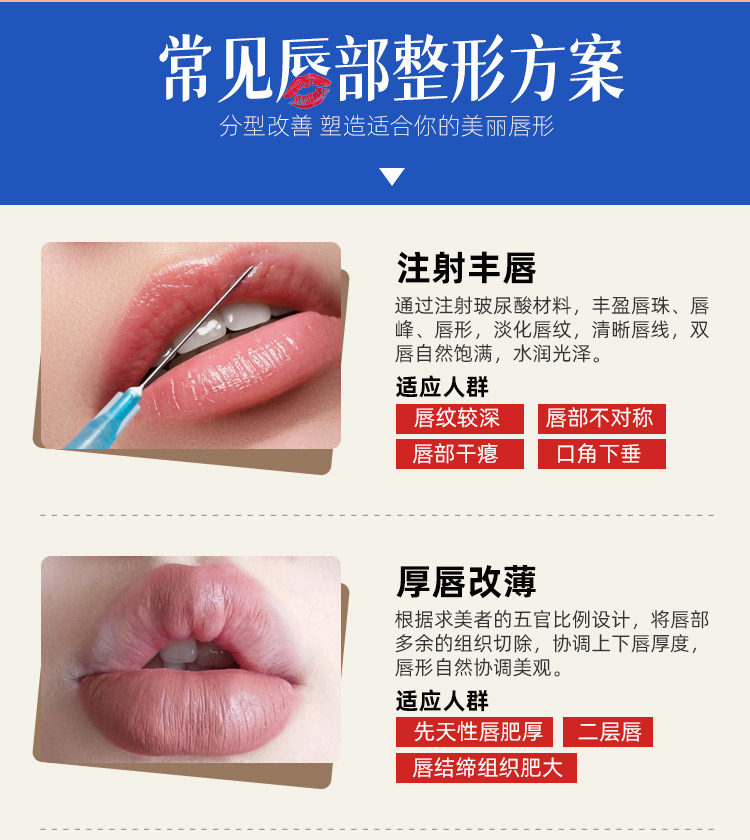 华美唇部整形方案