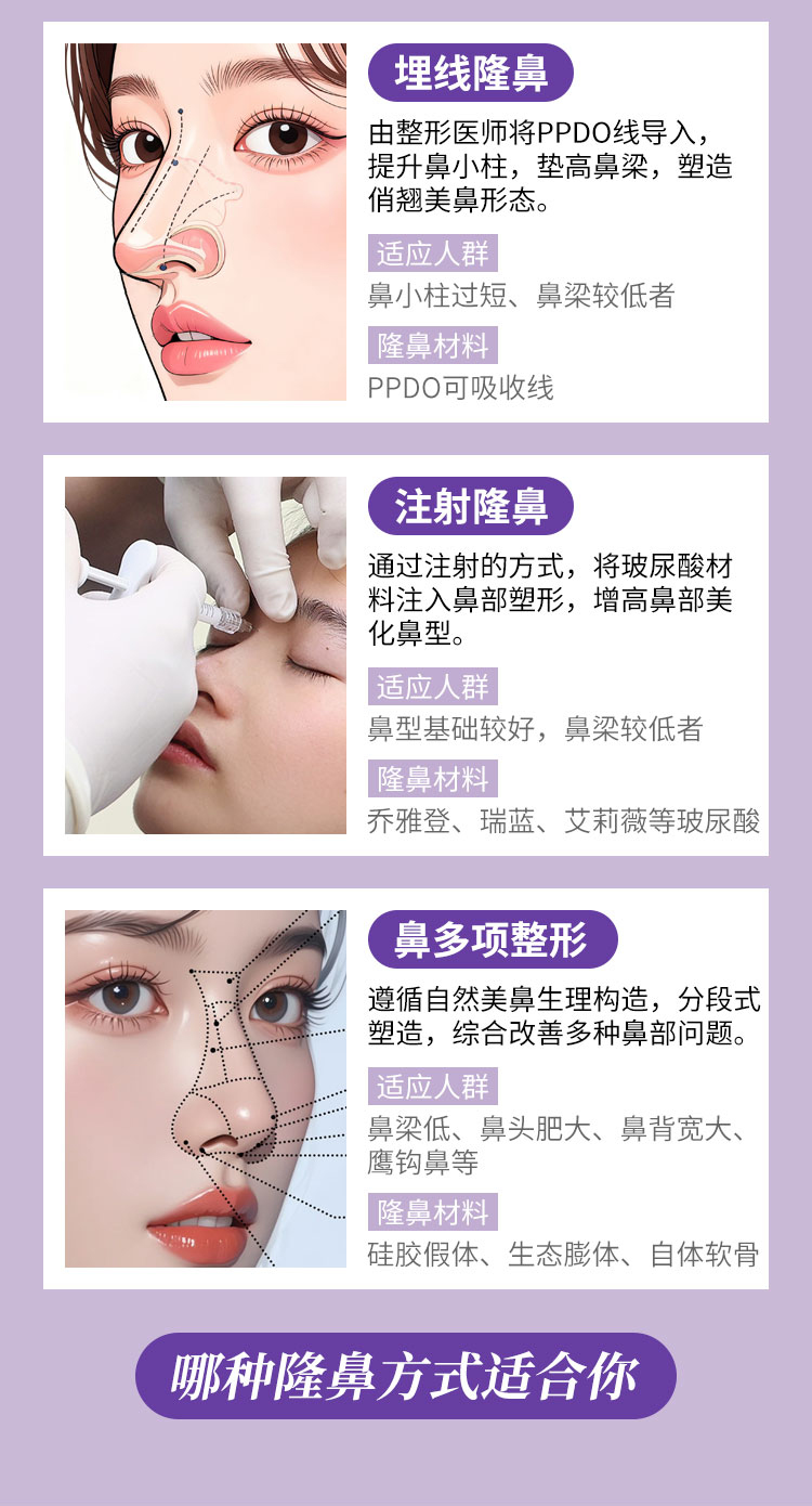 南宁隆鼻方案哪种好