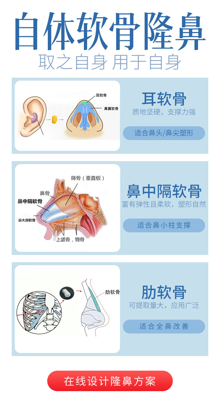 自体软骨隆鼻材料选择