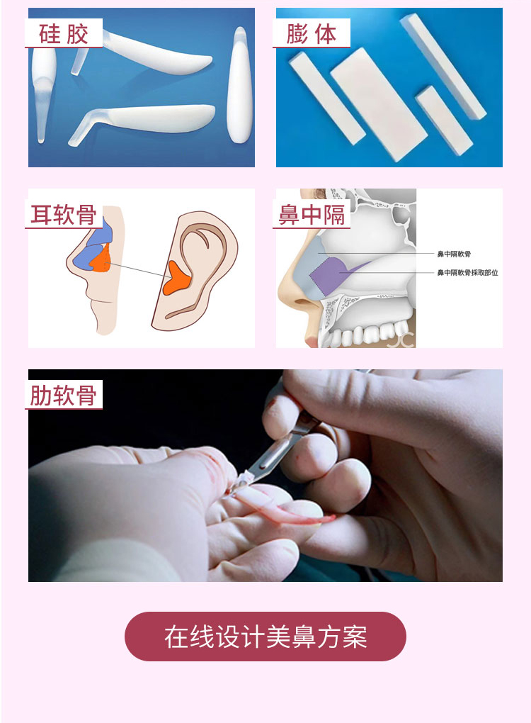 华美隆鼻材料选择