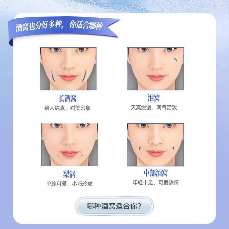 酒窝的类型有哪些