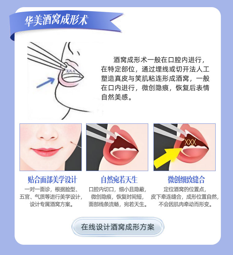 华美酒窝成形术