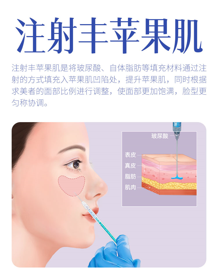 华美注射丰苹果肌