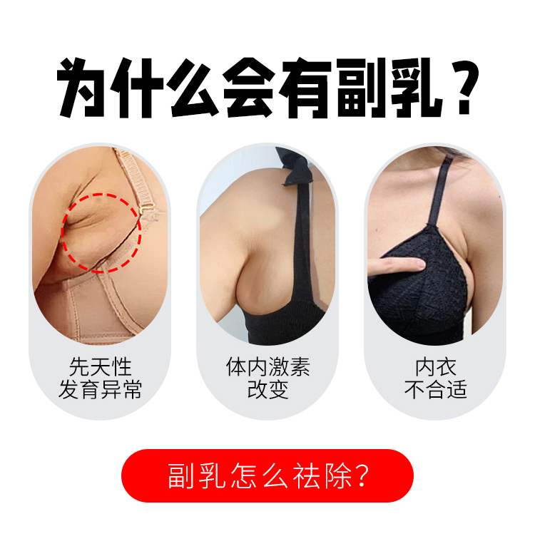副乳产生的原因有哪些