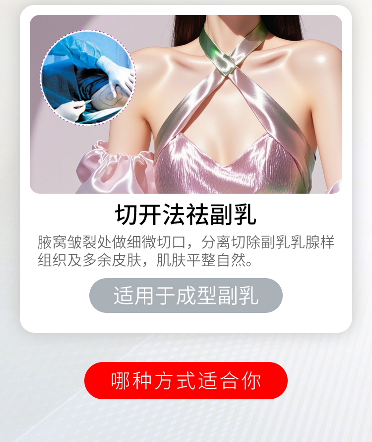 华美切开法祛副乳