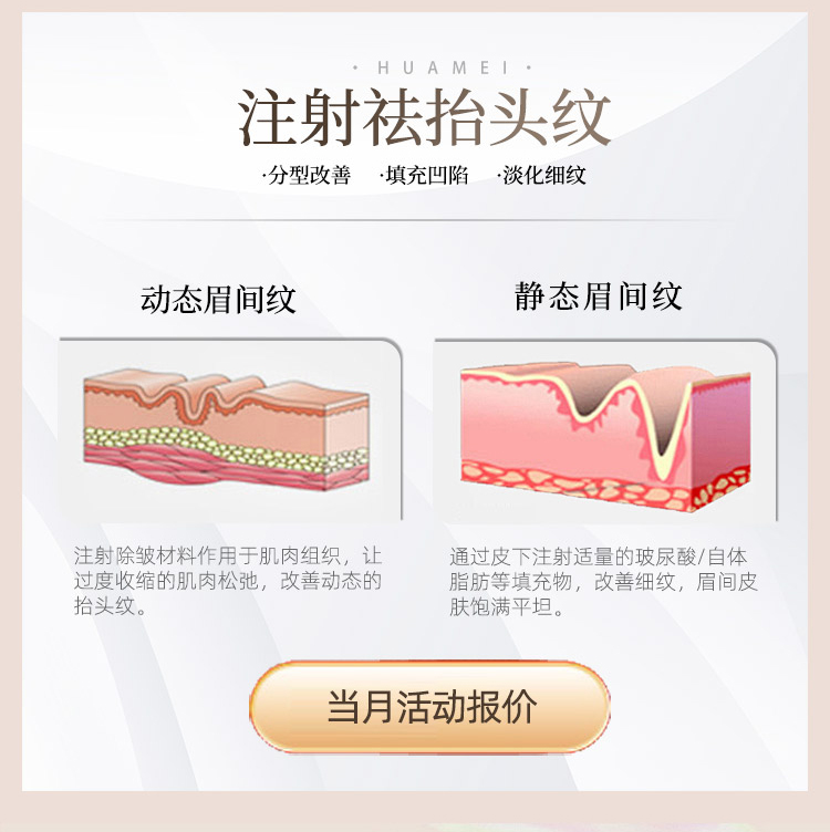 注射去抬头纹怎么样