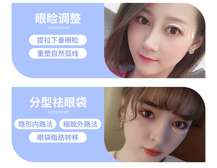 南宁华美医疗美容医院双眼皮手术方案