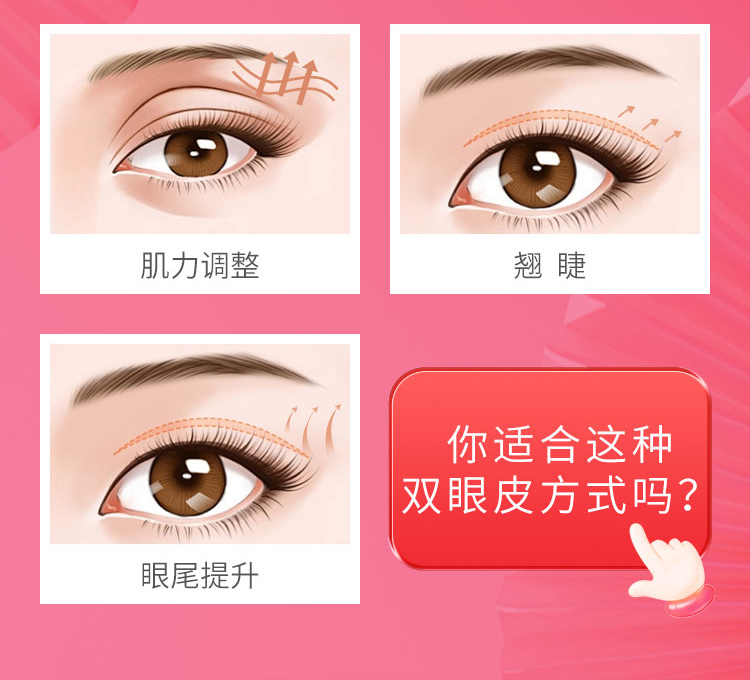 纯欲桃花眼手术方案