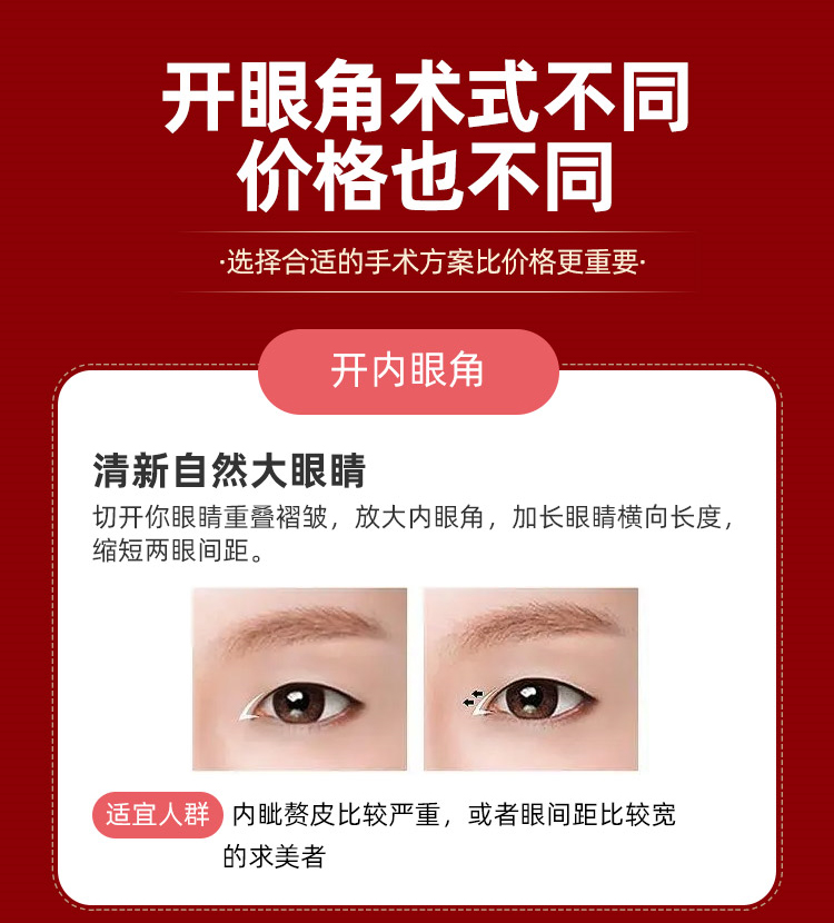 开内眼角