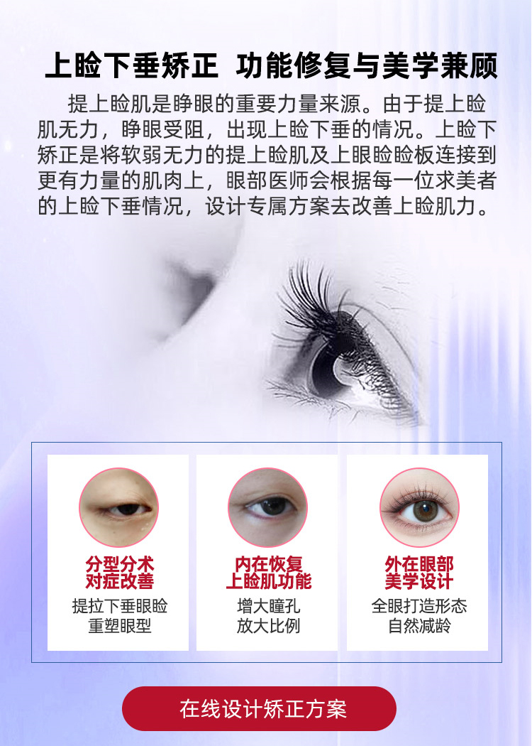 上睑下垂矫正方法