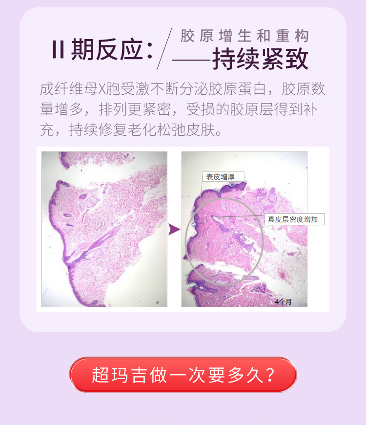 超玛吉