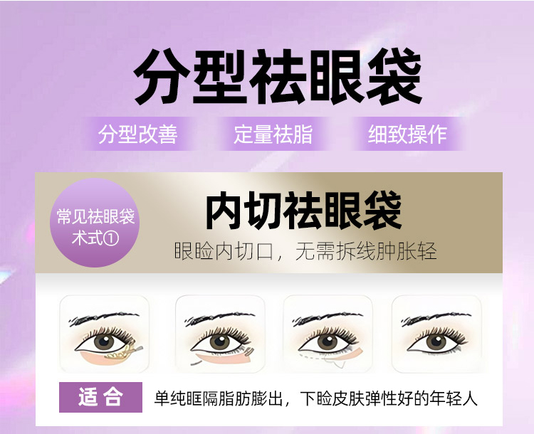 内切祛眼袋