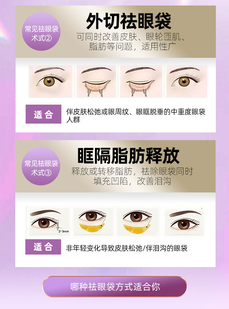 祛眼袋方法哪种好