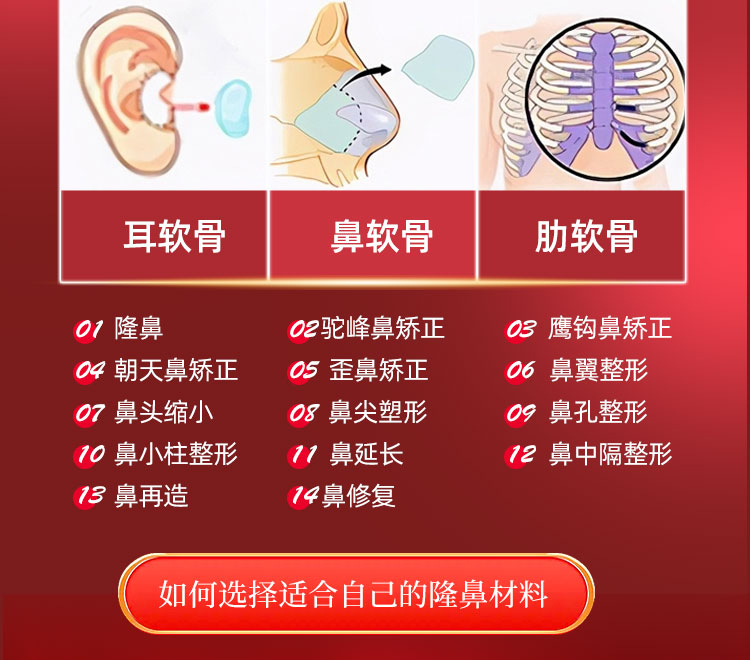 妈生鼻材料术式