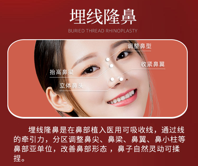 什么是埋线隆鼻