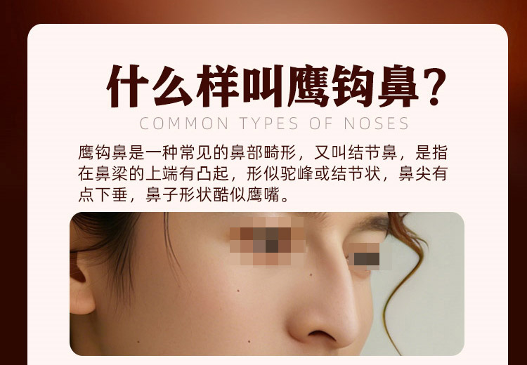 什么是鹰钩鼻