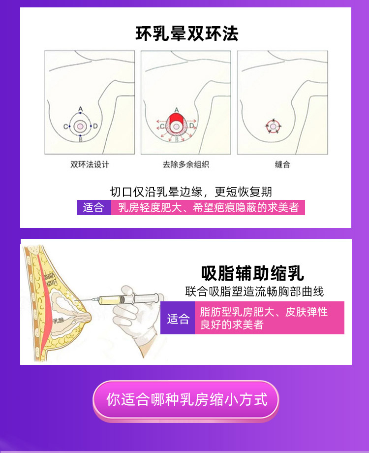 乳房缩小手术方法