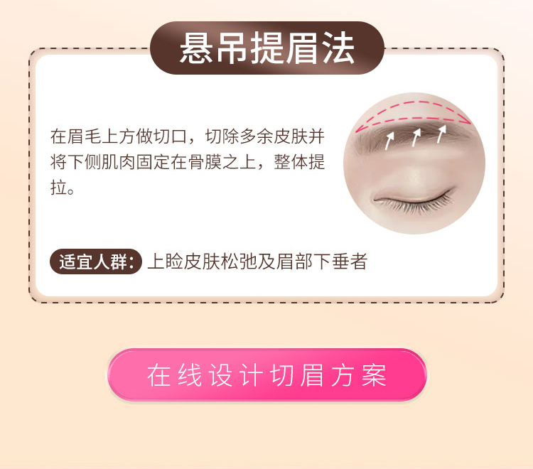 华美切眉方法选择
