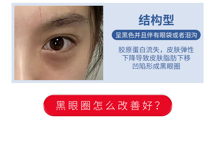 黑眼圈类型