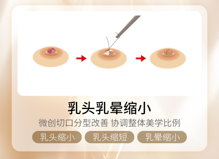 乳头乳晕缩小
