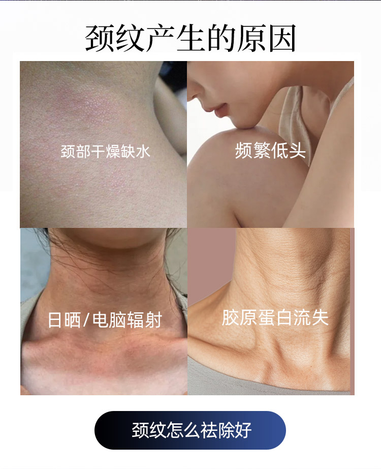 颈纹产生的原因