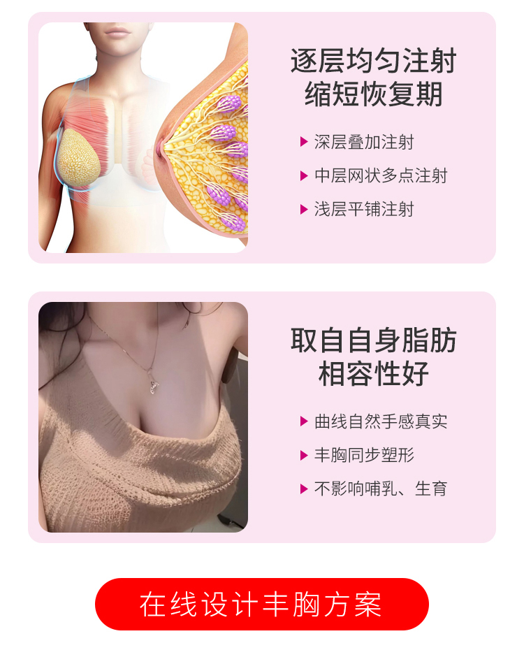 自体脂肪丰胸优势