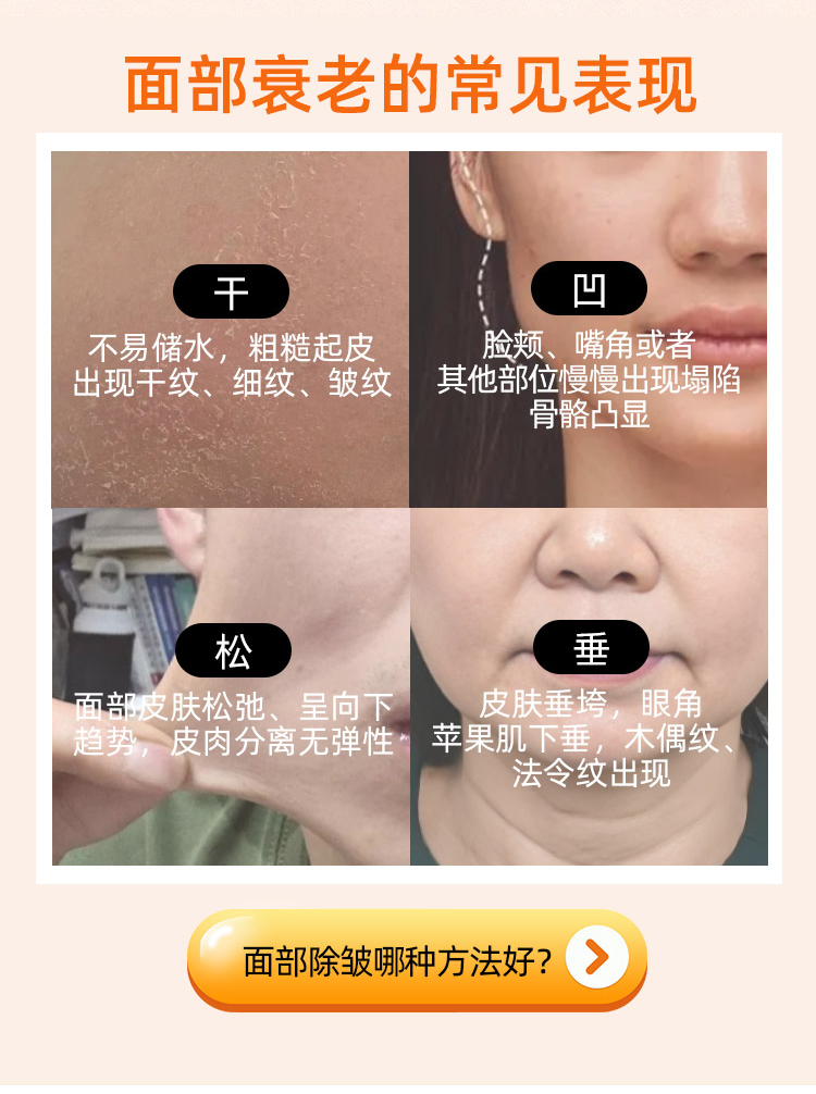面部衰老的常见表现