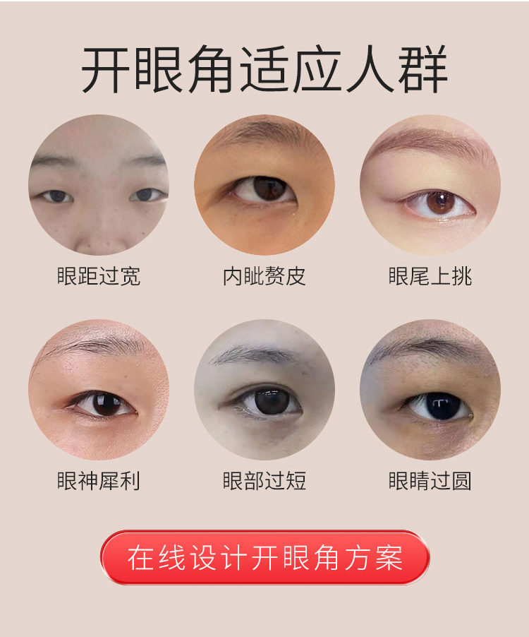 开眼角适应人群
