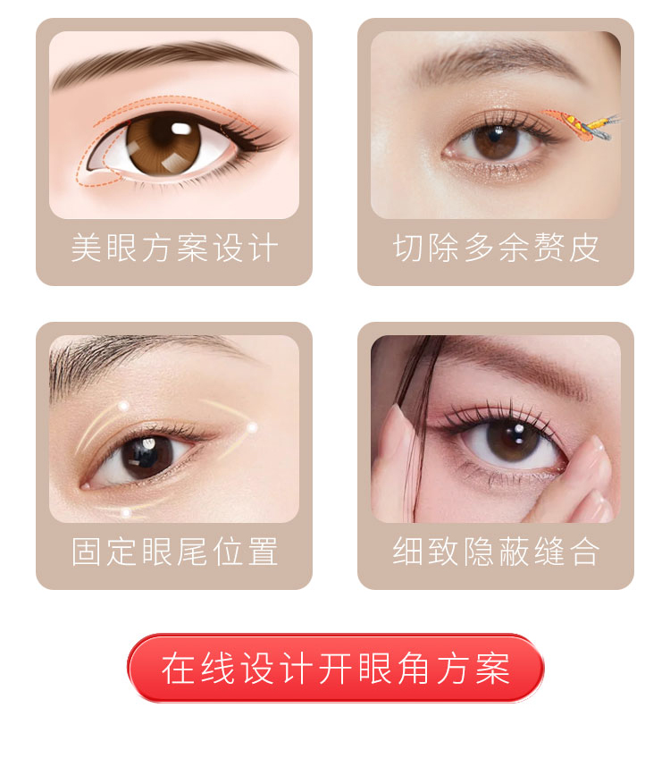 南宁做开眼角哪家好