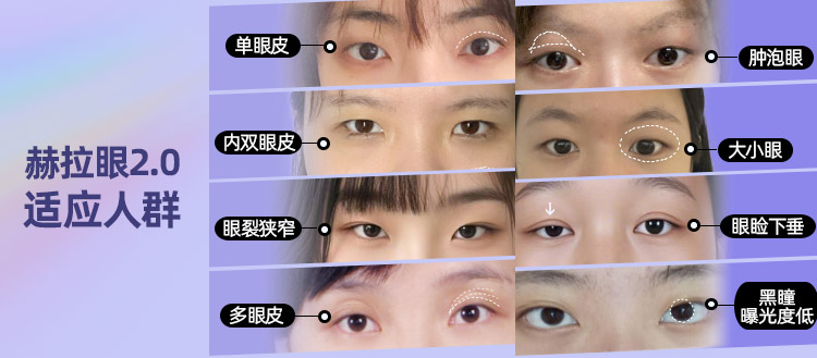 华美赫拉综合美眼适应症