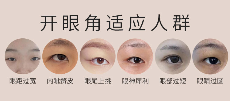 华美开眼角适应人群
