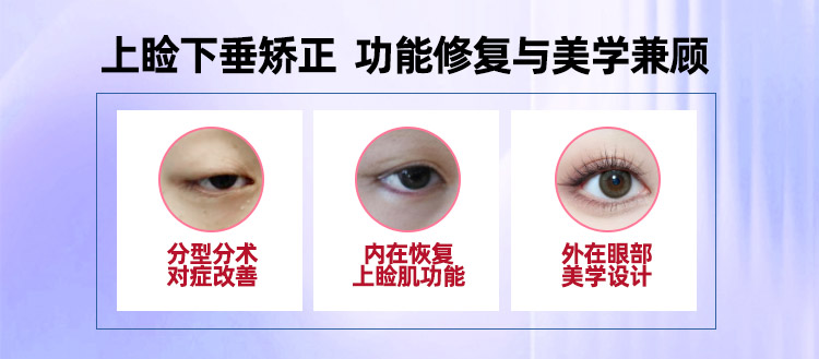 华美上睑下垂优势