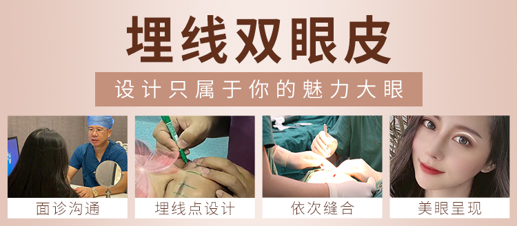 华美埋线双眼皮