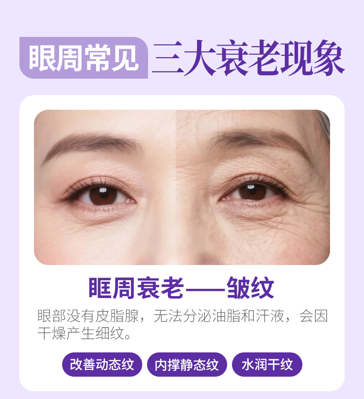 眼周衰老现象