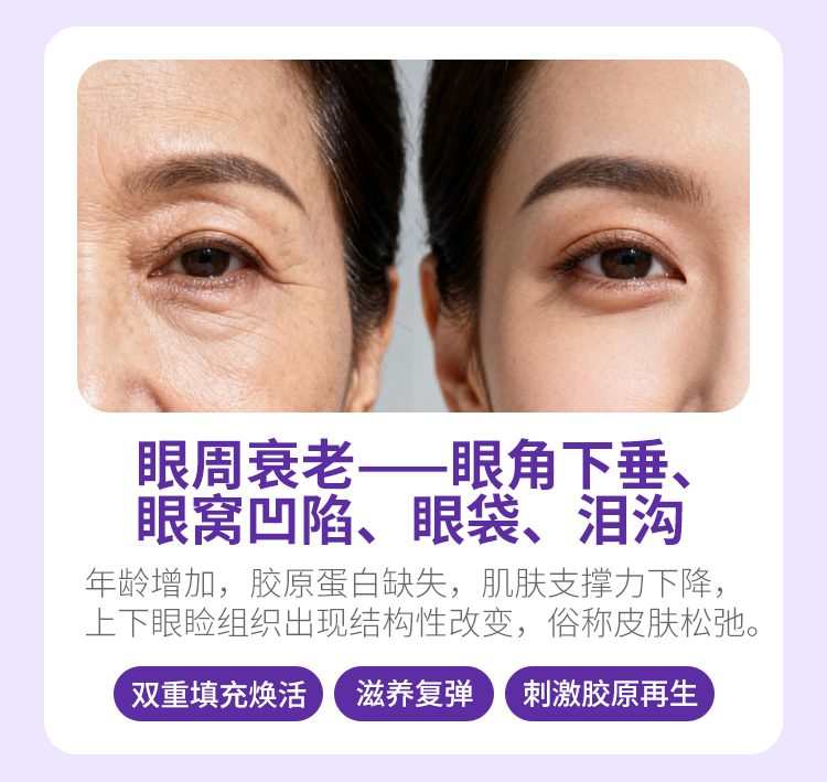 眼周衰老表现