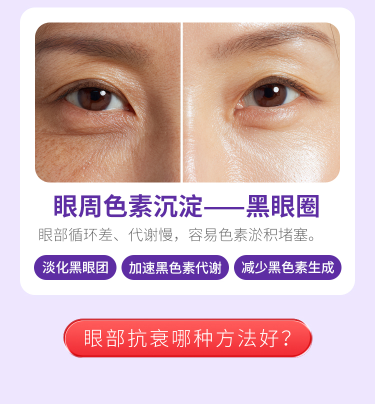 眼周衰老表现