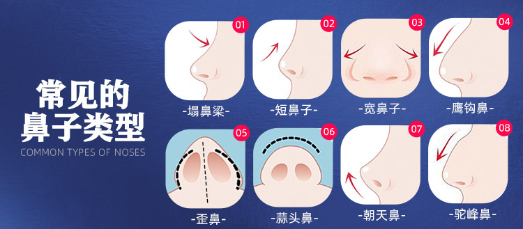华美新生代原生鼻,广西靠谱整形医院,广西实力强的整形医院