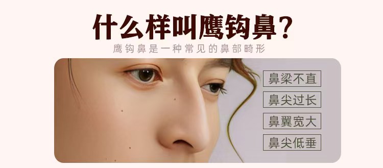 南宁鹰钩鼻怎么矫正,南宁鹰钩鼻矫正医院,南宁鼻整形医院,广西老牌整形医院