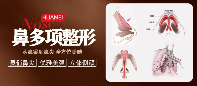 南宁鹰钩鼻怎么矫正,南宁鹰钩鼻矫正医院,南宁鼻整形医院,广西老牌整形医院