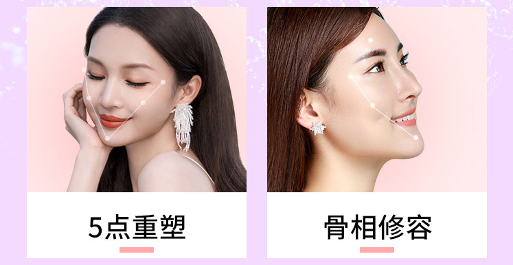 南宁魅续玻尿酸适应症,魅续玻尿酸价格,南宁打玻尿酸哪家好,南宁玻尿酸报价,南宁微整形医院,广西口碑好的整形医院