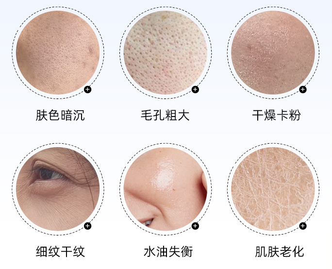 南宁打水光哪家好,南宁水光补水医院,南宁水光配方方案,南宁美肤哪家好,南宁整形医院,广西正规整形医院