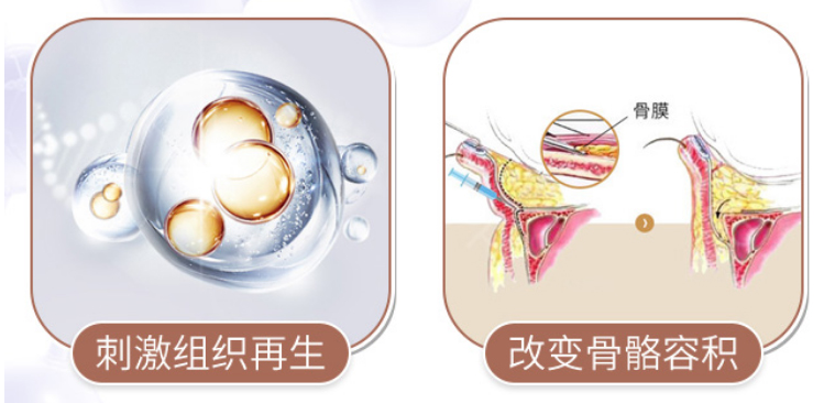 南宁爱贝芙注射适应症,南宁爱贝芙价格,南宁打爱贝芙哪家好,南宁微整形医院,广西资深整形医院